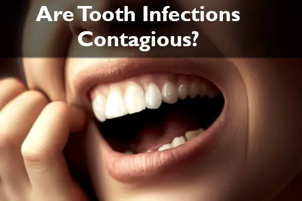 Are Tooth Infections Contagious