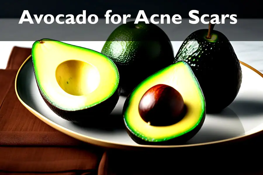 Avocados for acne scars