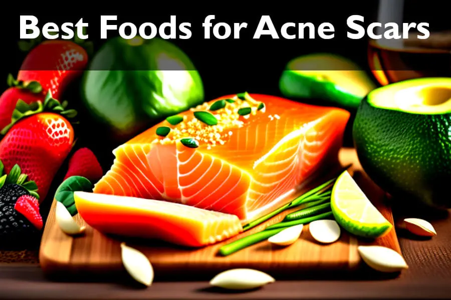best foods for acne scars