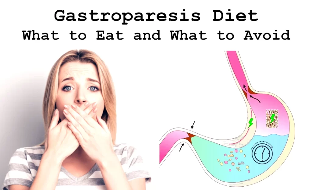 diet for gastroparesis: what to Eat and What to Avoid