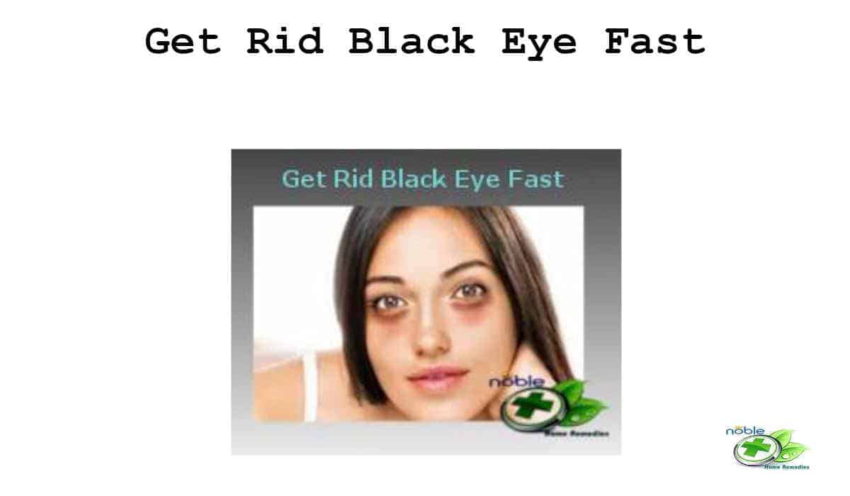 Get Rid Of Black Eye Fast