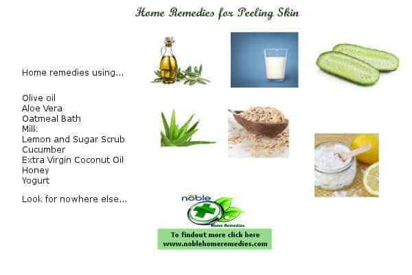 Home Remedies for Peeling Skin. Natural ways to get rid of peeling skin fast and safe