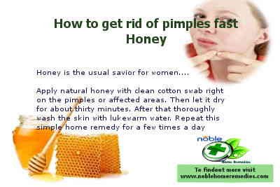 How to get rid of pimples fast - Honey