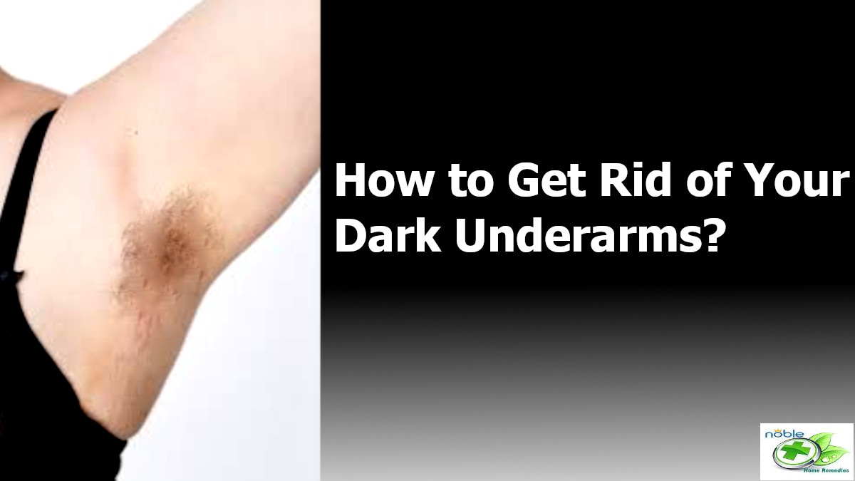 How to Get Rid of Dark Underarms? 15 Natural Remedies, Causes and