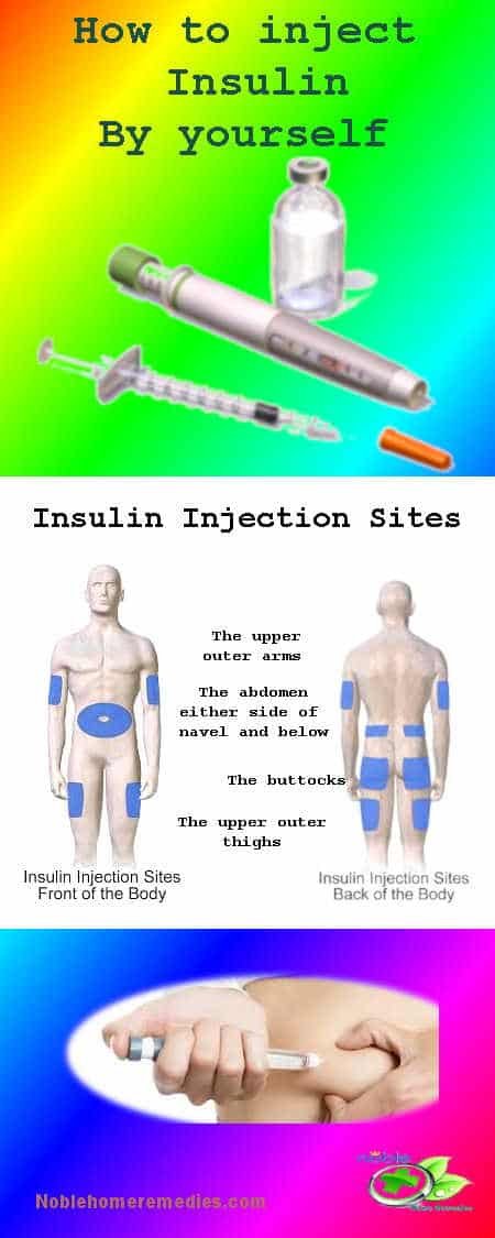 Insulin Injection Sites - How to Inject DYI