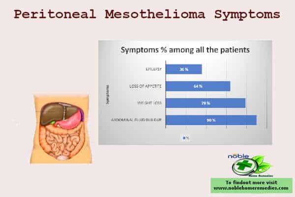 Peritoneal Mesothelioma Symptoms