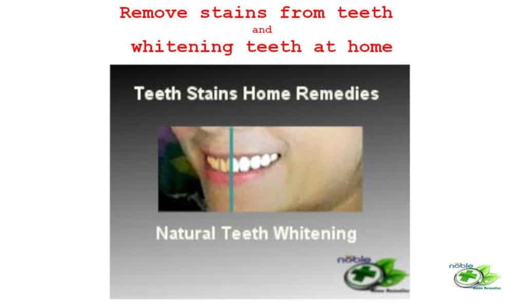 Remove Stains from Teeth Naturally