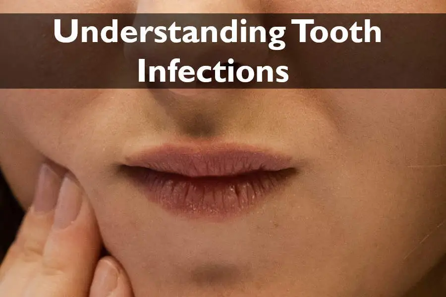 tooth infections