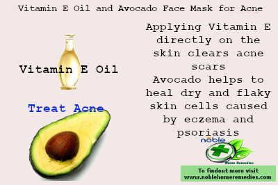 Vitamin E and Avocado Face Mask Vitamin E and Avocado Face Mask