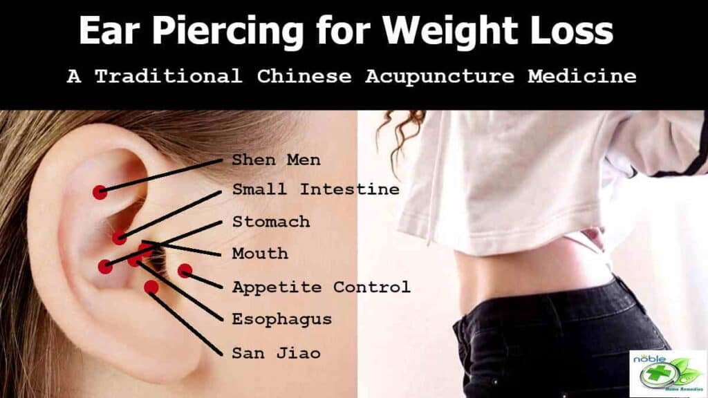 ear piercing or ear stapling for weight loss