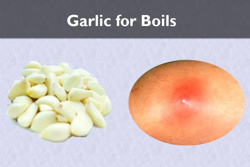 garlic for boils - treatment