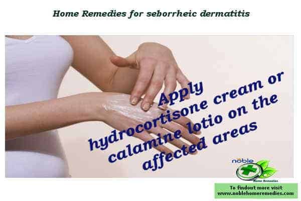 hydrocortisone cream or calamine lotion for seborrheic dermatitis