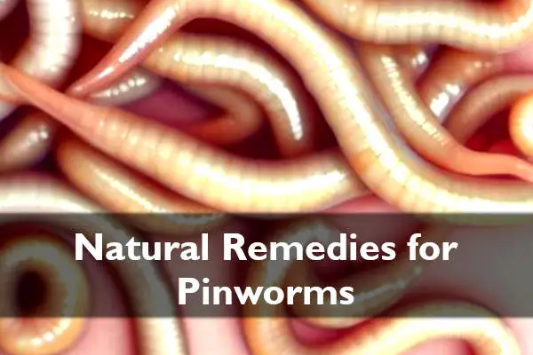 pinworms and how to get rid of pinworms