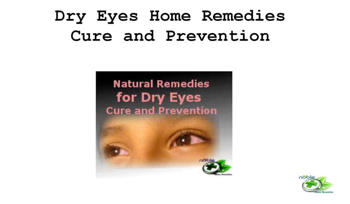 Natural Remedies For Dry Eyes Cure and Prevention